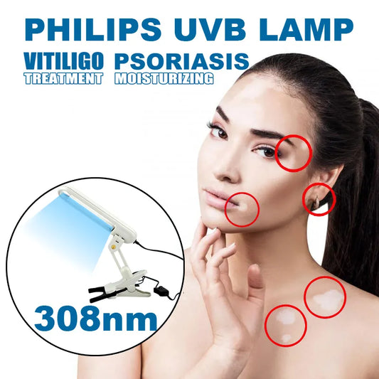 Glenn UVB 308nm Narrow Band UVB Lamps Household UVB Phototherapy For Vitiligo Psoriasis Treatment