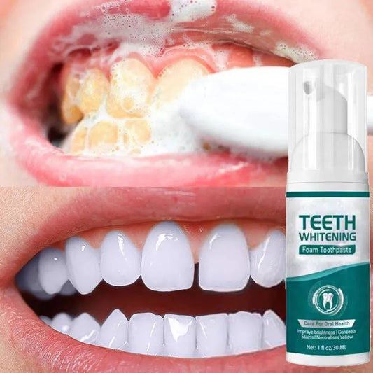 Teeth Whitening Mousse Dental Care Essence Remove Plaque Tooth Stain Gingival Repair Caries Prevention Oral Cleaning 30ml